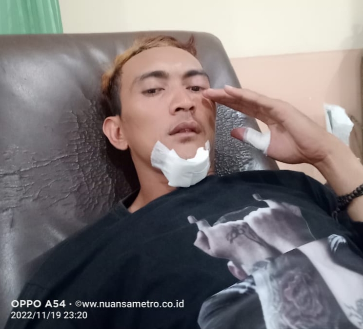 Kekerasan Terhadap Wartwan Terjadi Lagi  Di Karawang