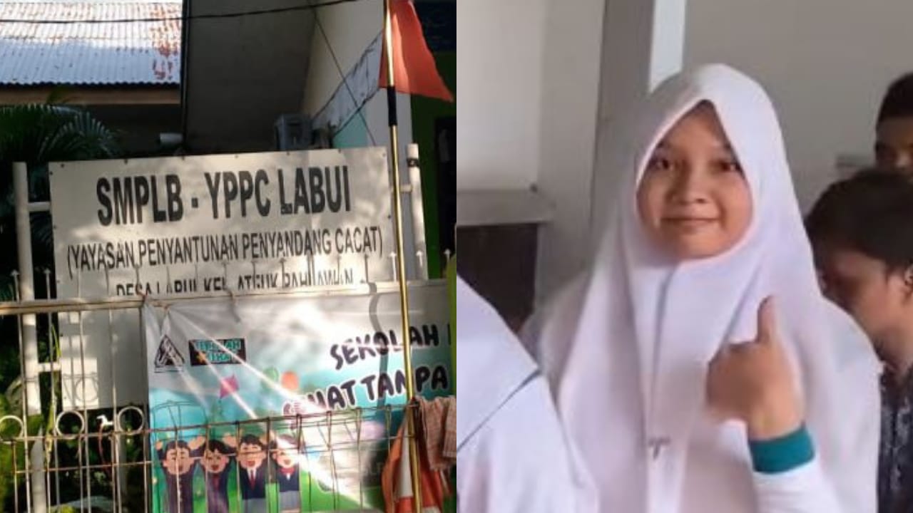 seorang anak disabilitas tunagrahita, Zakiya (Foto: Dok istimewa)